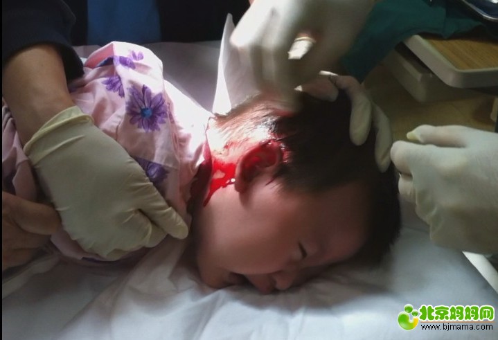 血淋淋的教训世贸天阶的理发师把孩子耳朵剪破了附图片还有视频