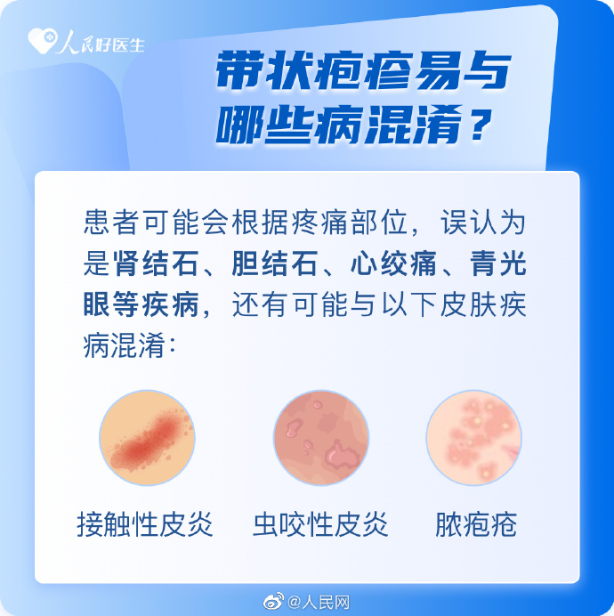 【全国护肤日｜帮您预防带状疱疹】8.jpg